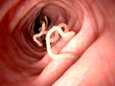 Can humans get Tapeworms from Cats? » Petsoid